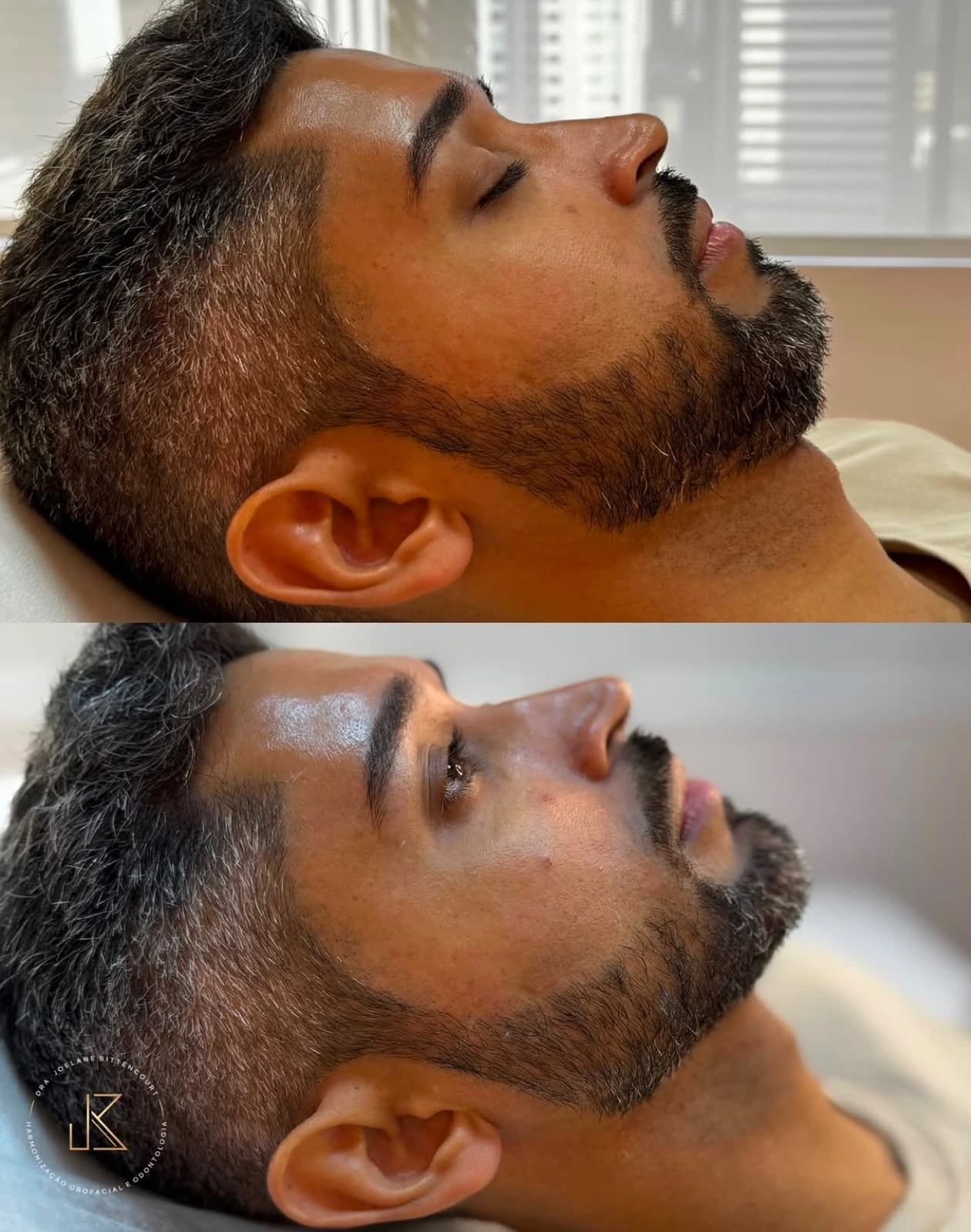 Registro 05 de antes e depois fornecido pela Dra. Joelane Bittencourt: identidade em cada ângulo